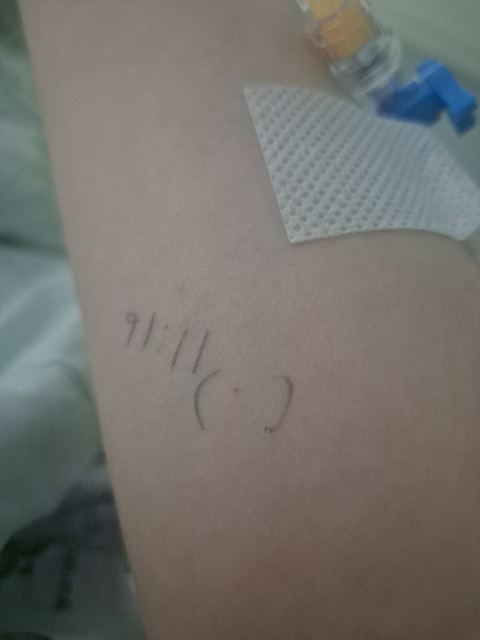 자궁 용종 수술