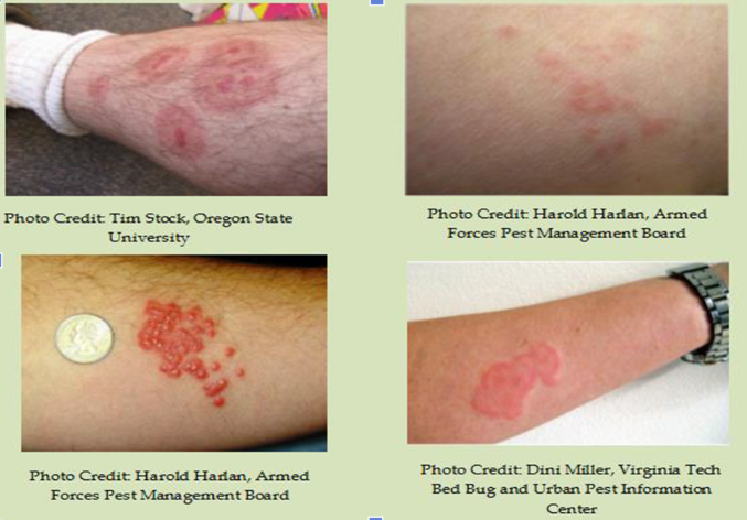 출처=질병관리청 빈대정보집