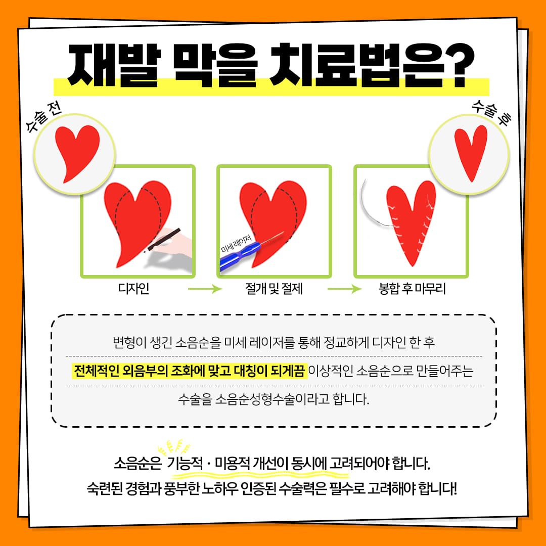 소음순 가려움 해결하는 치료법은?