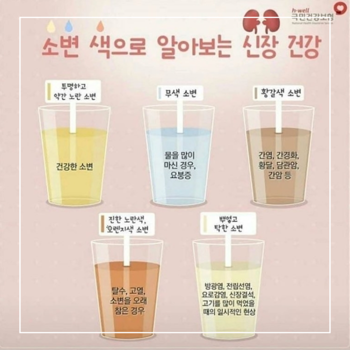 소변색으로 알아보는 신장 건강