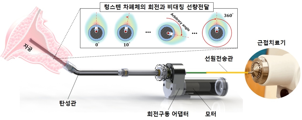 암 방사능 치료