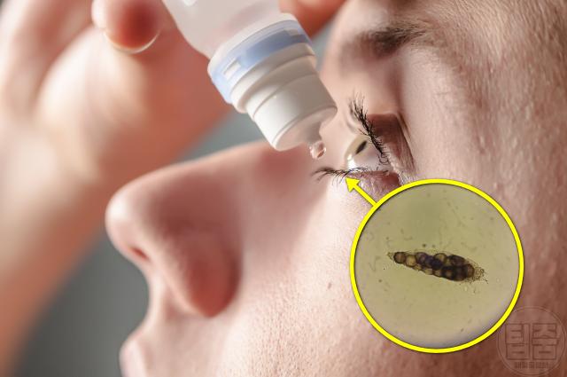 눈건조증 치료 관리 눈꺼풀 세정제