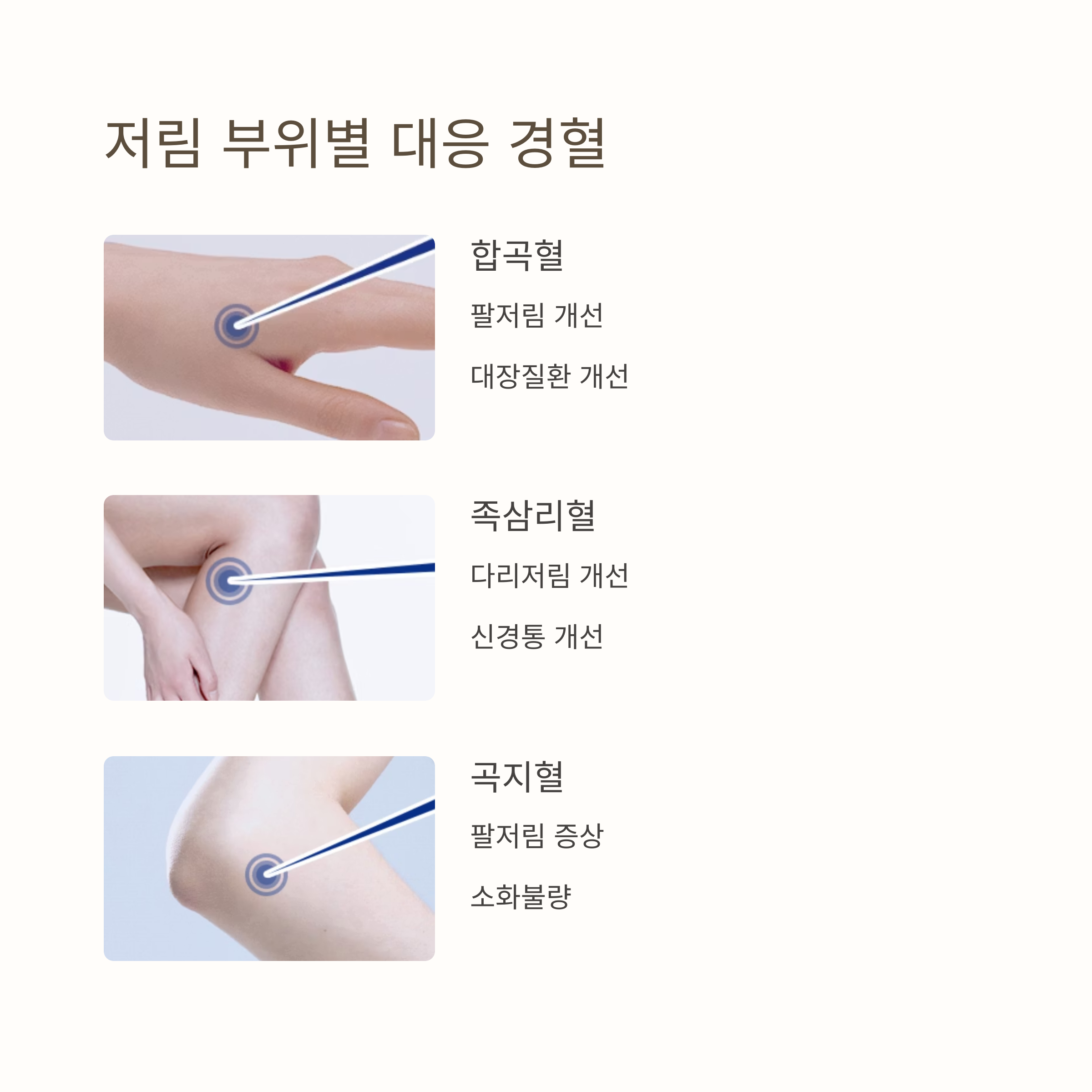 손발 저림에 수지침