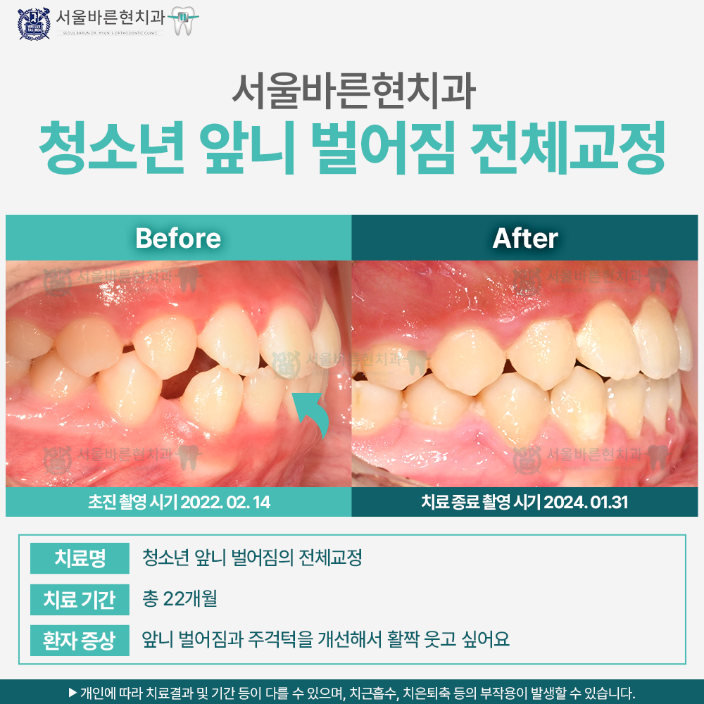 부산교정치과