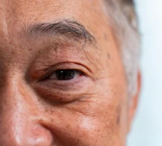 백내장 수술 후 시력회복 기간 주의사항 정리