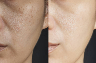 글루타치온 효능, 부작용, 많이든 음식 총정리 (2025ver)