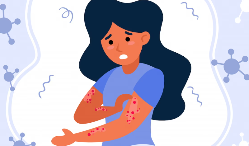 습하고 더우면 찾아오는 땀띠 미리 예방해요