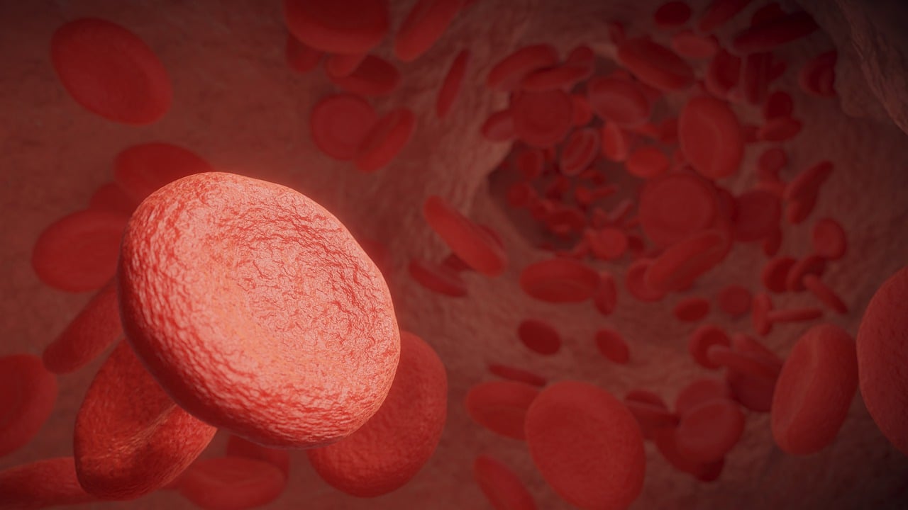 재생불량성 빈혈