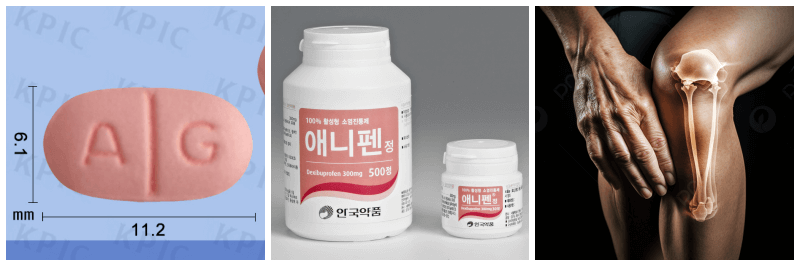 애니펜정, 관절염 사진