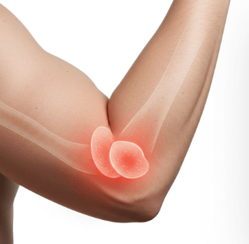 팔꿈치 통증 원인과 치료법2