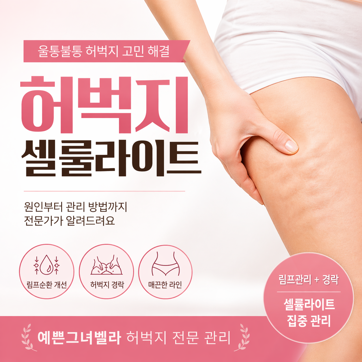 허벅지 셀룰라이트