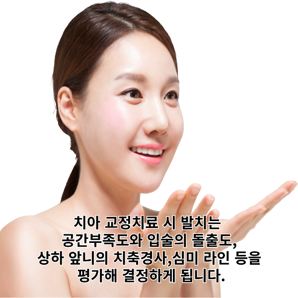 치아-교정치료-발치-썸네일