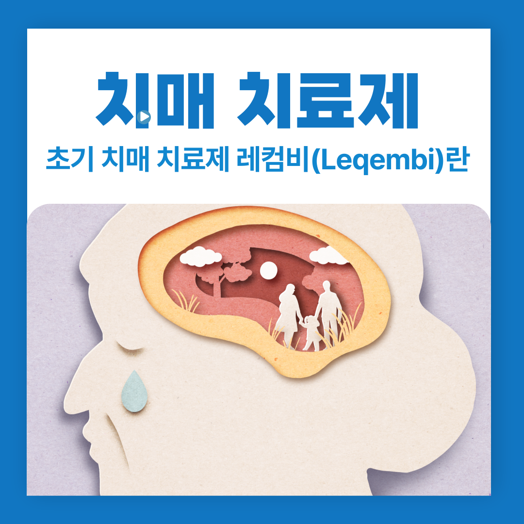 초기 치매 치료제 레컴비(Leqembi)란