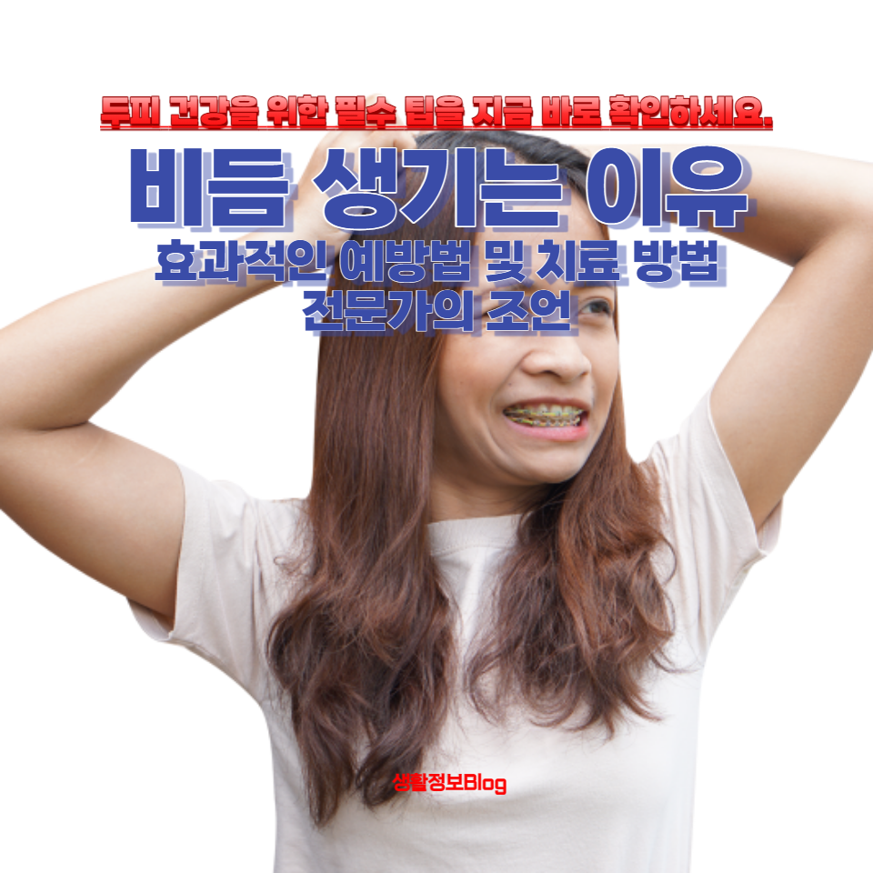 비듬의 주요 원인: 함께 효과적인 예방법 및 치료 방법