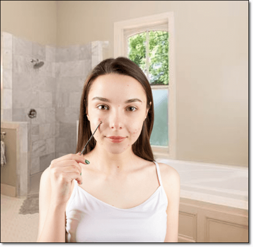 얼굴 여드름 여성