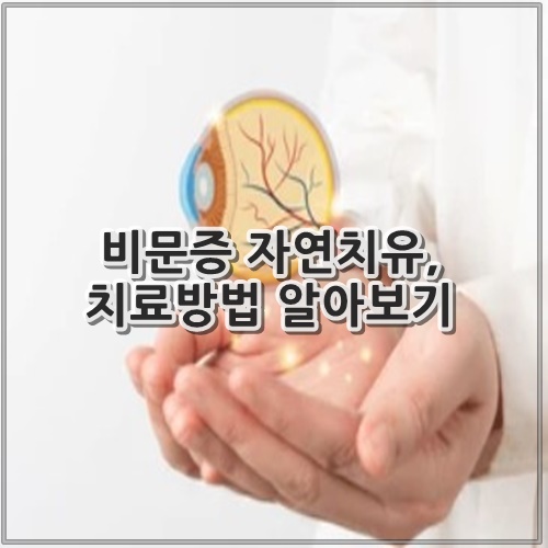 비문증 자연치유, 치료방법 알아보기