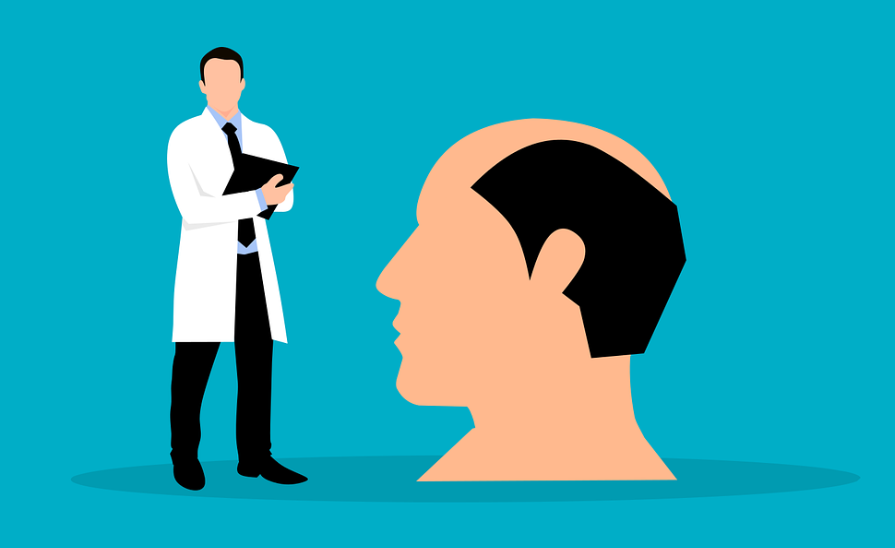 남성 탈모 특징과 치료방법