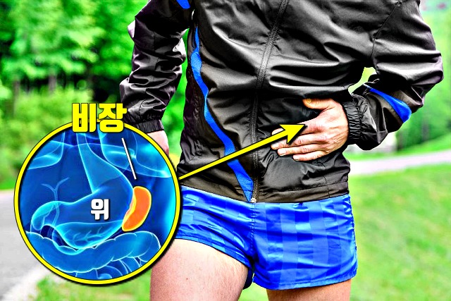 왼쪽 옆구리 통증 의심되는병 비장염, 건강 팁줌 매일꿀정보