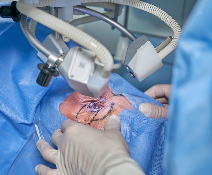 눈 수술 하는 사진