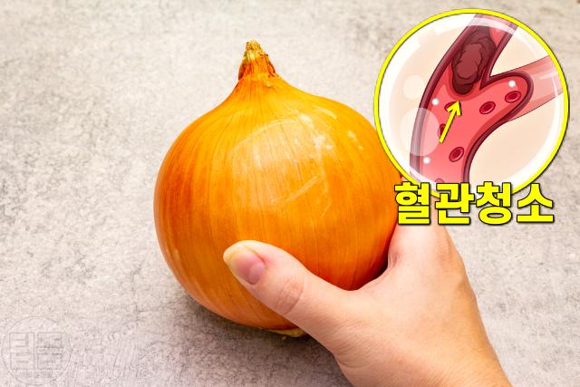 나트륨 배출 음식,양파 효능,팁줌