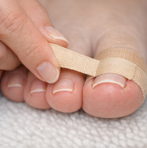 내성발톱 안생기는법(교정 및 치료 방법) 완벽 가이드 2026