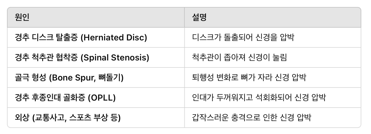 신경 뿌리 압박의 원인 (경추 신경근병증)
