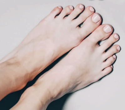 티눈 없애는 방법