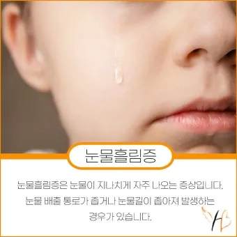눈물이 자주 나는 이유에 대한 안과정보_27