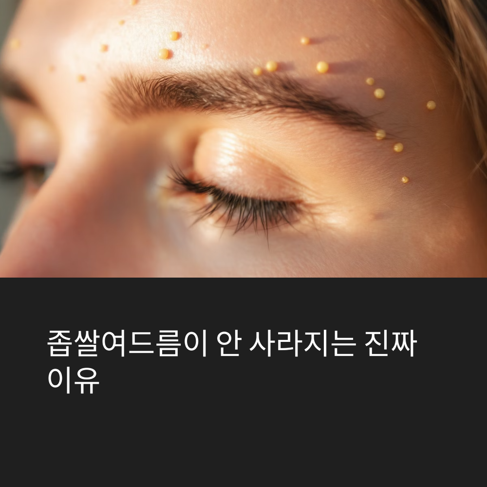 좁쌀 여드름이 사라지지 않는 진짜 이유 썸네일