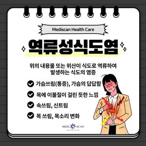 역류성식도염증상