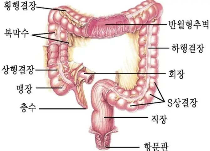 대장암 예방
