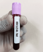 대상포진 예방접종 가격