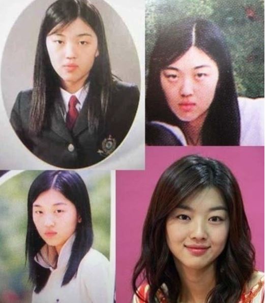 장희진 성형전