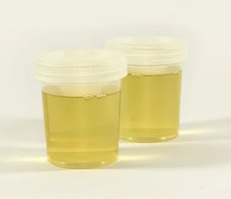 농지 화장실 설치 8월 28일부터
