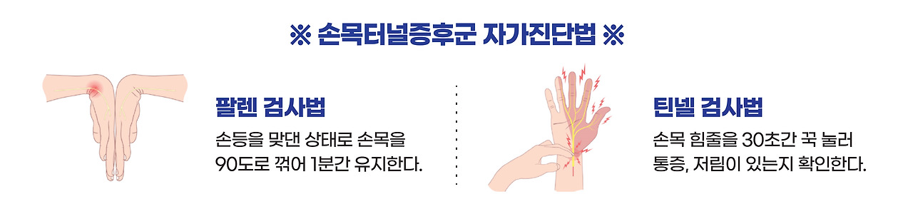 손목터널증후군 증상·원인·치료