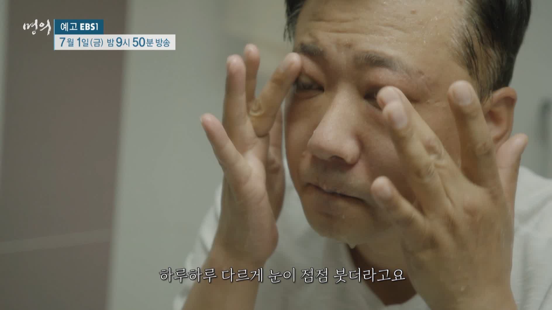 명의 갑상선호르몬 성장호르몬 쿠싱증후군 나잇살 고도비만 골다공증 호르몬 극복 치료법 내분비 내과 안철우 교수