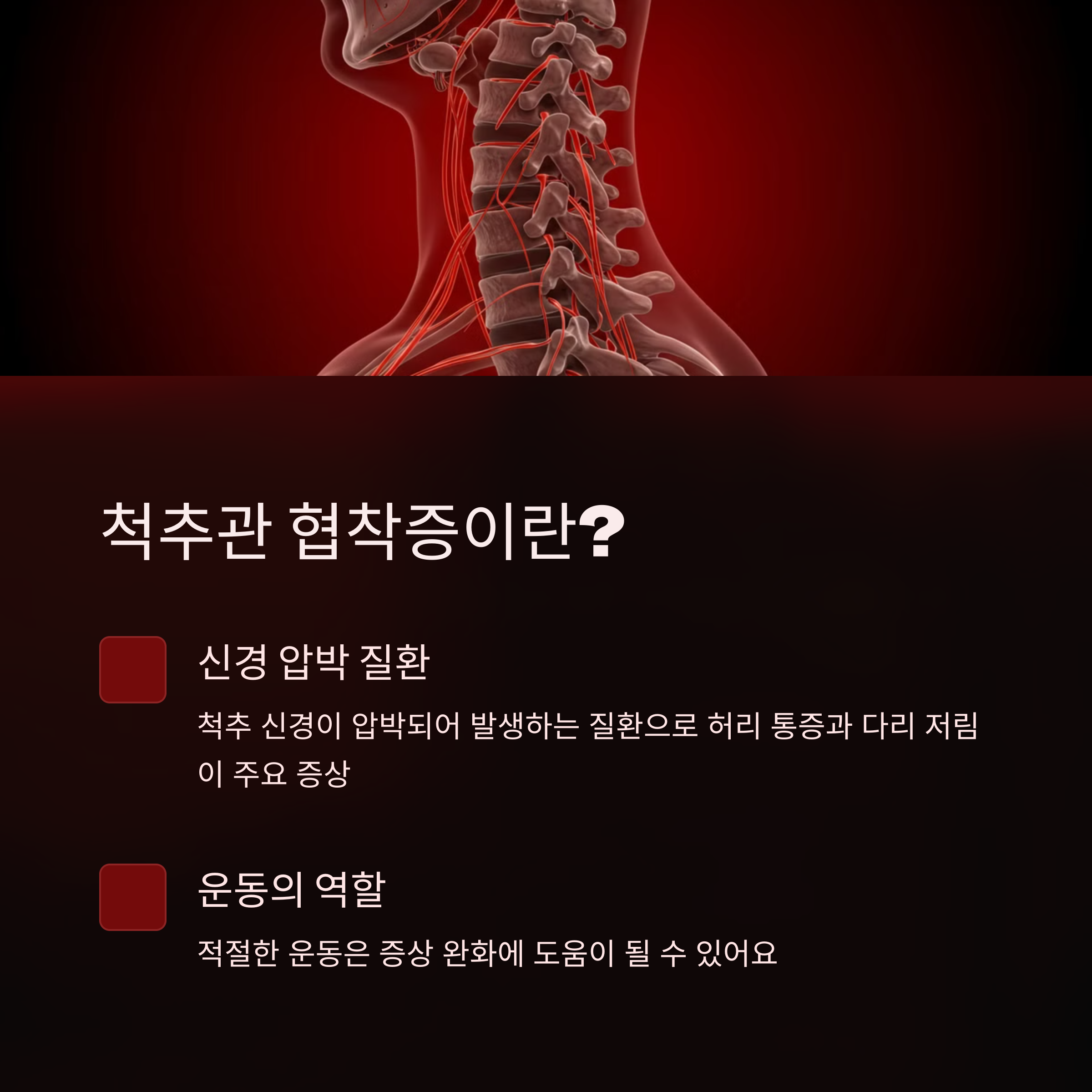 척추관 협착증이란?
