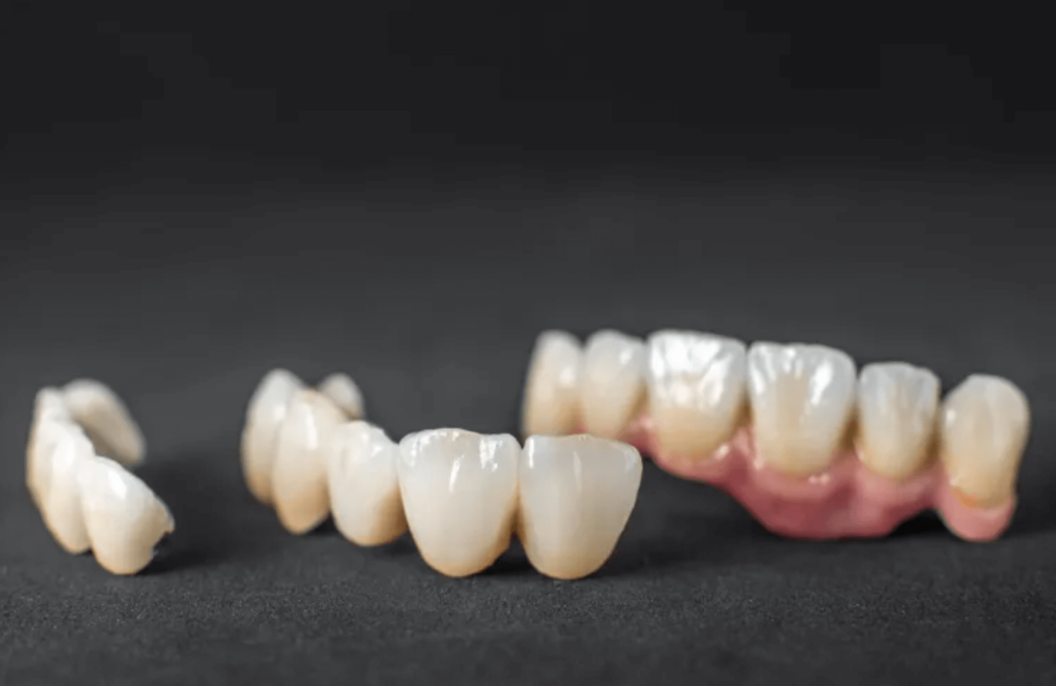 지르코니아 크라운