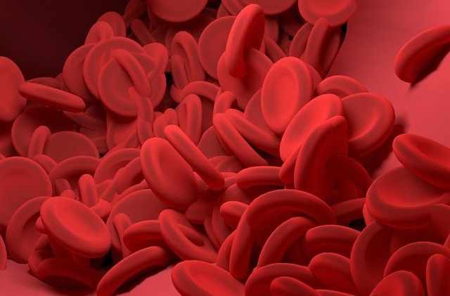 hdl콜레스테롤 정상수치