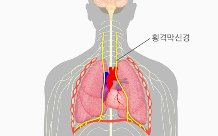 딸꾹질 원인 설명