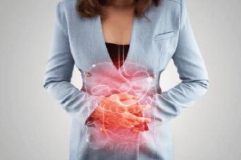 자극성 장 증후군