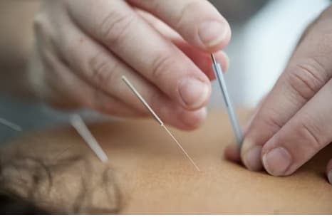 한방병원 진료비, 실비 적용 조건과 주의사항