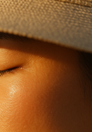 비립종 생기는 이유