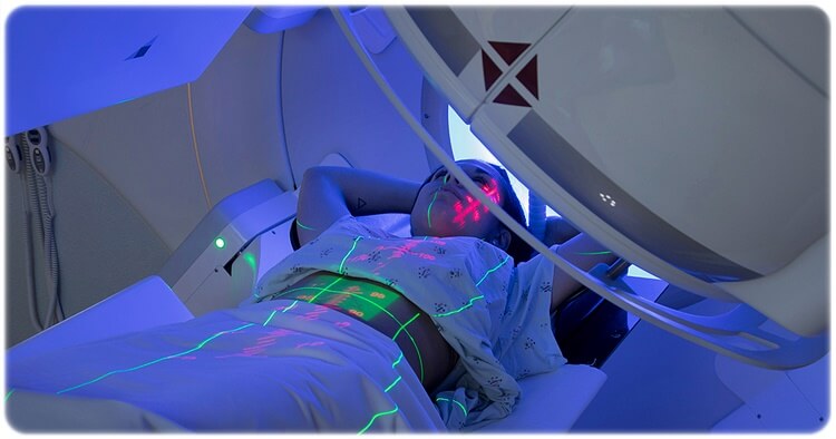 간암 초기증상 원인 진단 치료 예방 생존율