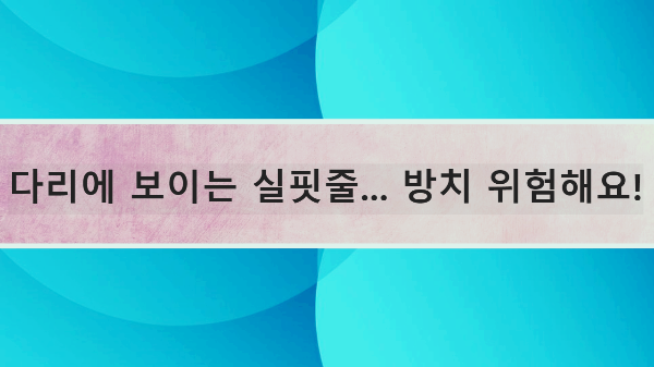 다리에 보이는 실핏줄... 방치 위험해요!