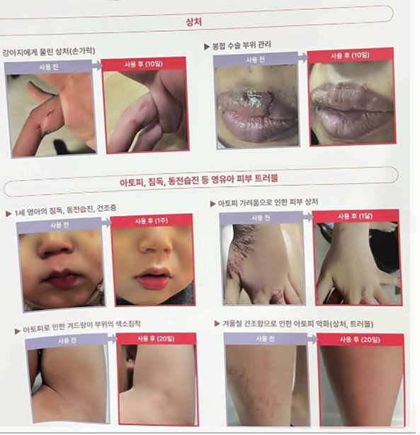 리프로덤겔효과-001