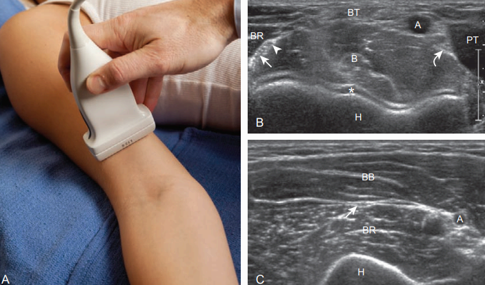 팔꿈치 앞쪽검사(anterior)