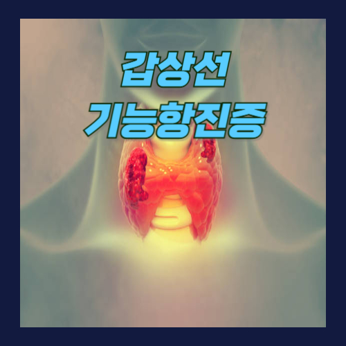 갑상선기능항진증