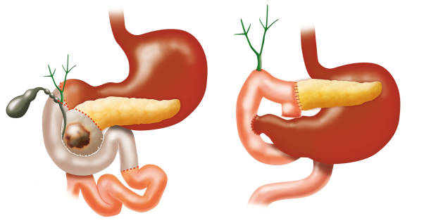 췌장암 신약 FDA 패스트 트랙 지정