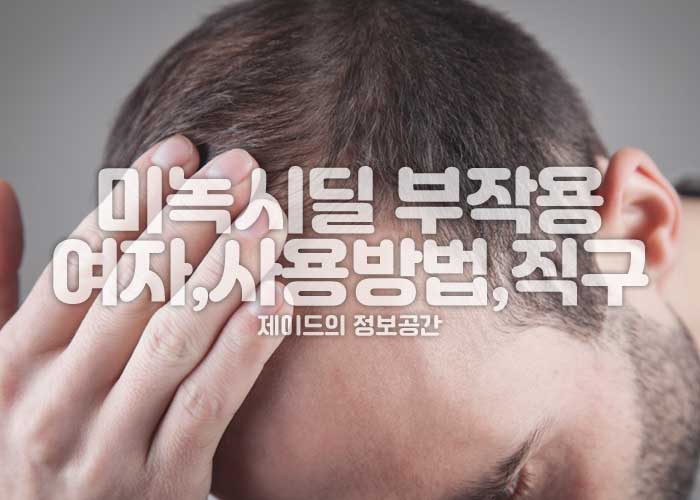 미녹시딜 부작용, 여자, 사용방법, 가격, 직구